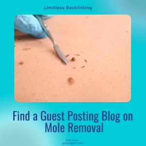 Find a Guest Posting Blog on Mole Removal