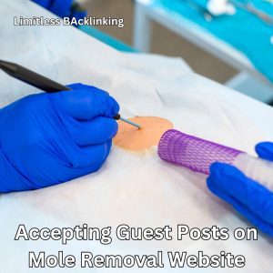 Accepting Guest Posts on Mole Removal Website
