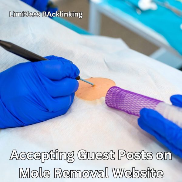 Accepting Guest Posts on Mole Removal Website